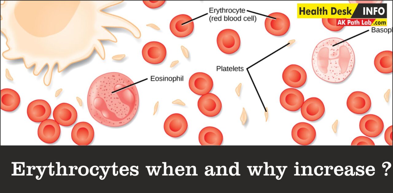 Erythrocytes when and why increase